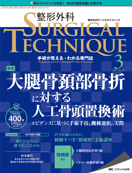 整形外科 SURGICAL TECHNIQUE 2021年3号　特集:大腿骨頚部骨折に対する人工骨頭置換術 エビデンスに基づく手術手技と機種選択の実際