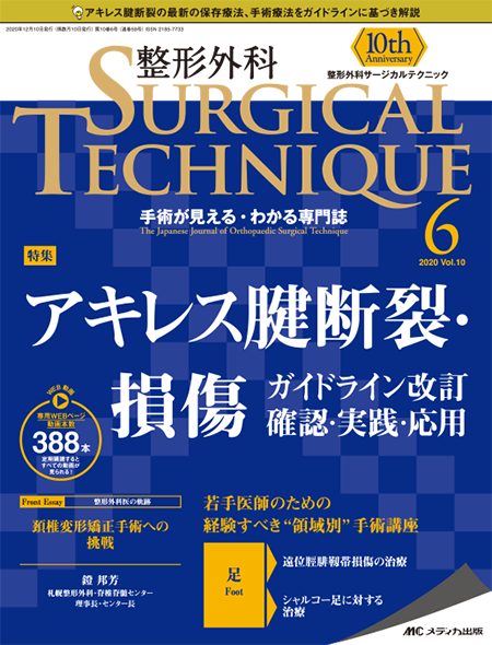 整形外科 SURGICAL TECHNIQUE 2020年6号 特集:アキレス腱断裂・損傷 ガイドライン改訂 確認・実践・応用