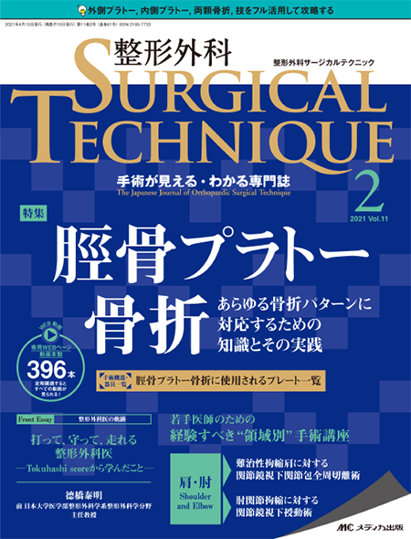 整形外科 SURGICAL TECHNIQUE 2021年2号　特集:脛骨プラトー骨折 あらゆる骨折パターンに対応するための知識とその実践