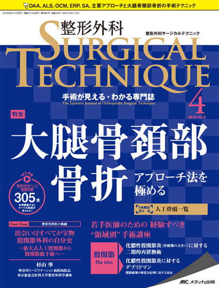 整形外科 SURGICAL TECHNIQUE 2018年4号　特集:大腿骨頚部骨折 アプローチ法を極める