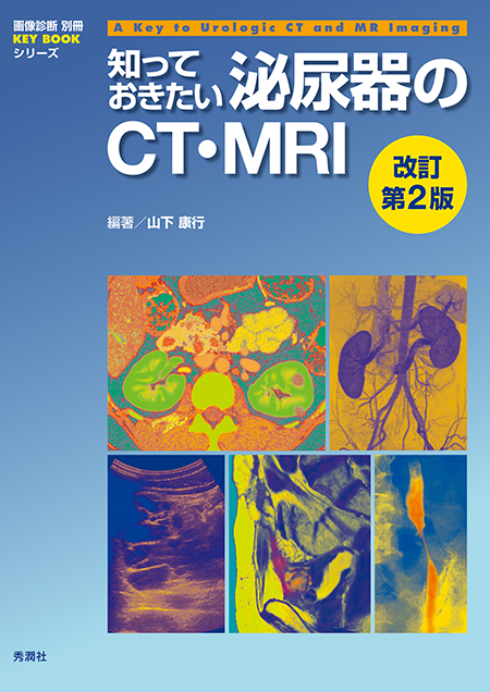 画像診断別冊 KEY BOOKシリーズ 知っておきたい泌尿器のCT・MRI改訂第2版