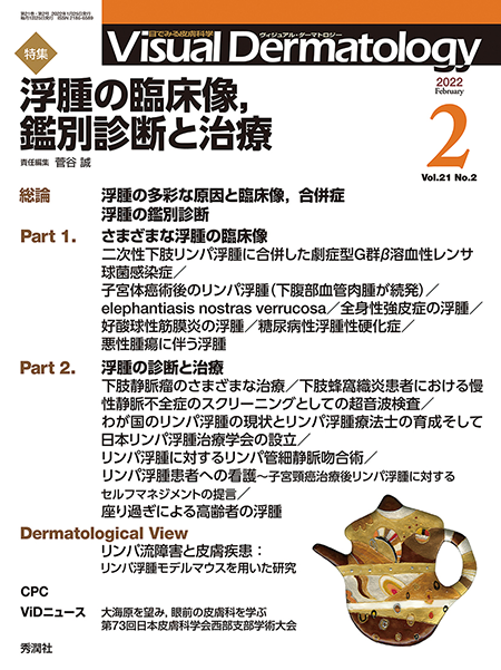Visual Dermatology　Vol.21 No.2（2022年2月号）浮腫の臨床像，鑑別診断と治療