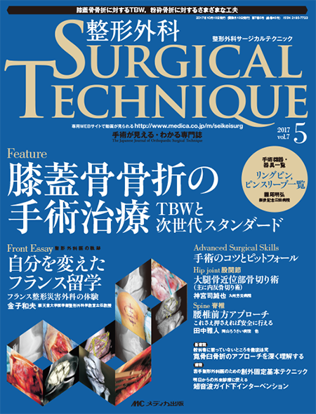 整形外科 SURGICAL TECHNIQUE 2017年5号　特集:膝蓋骨骨折の手術治療 TBW と次世代スタンダード