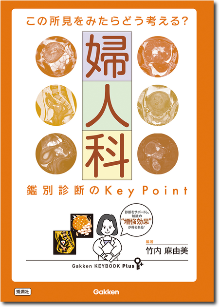 この所見をみたらどう考える? 婦人科 鑑別診断のKey Point