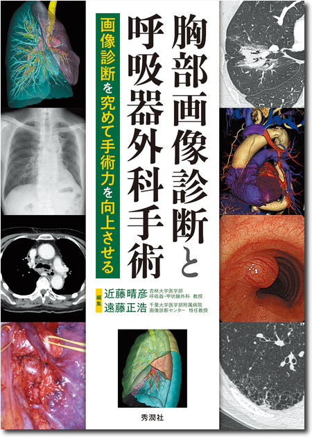 胸部画像診断と呼吸器外科手術