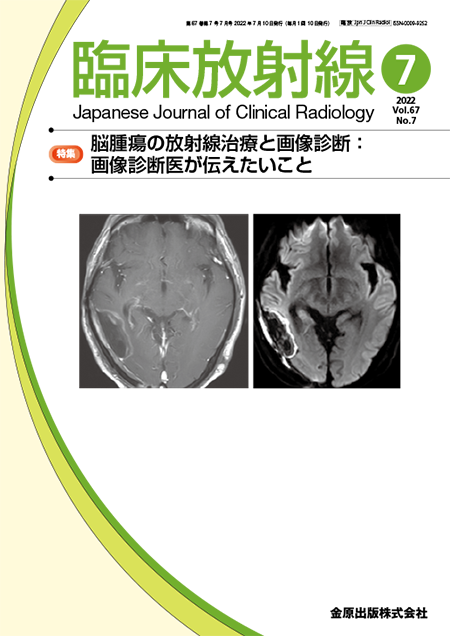 臨床放射線 2022年7月号 67巻7号 特集 脳腫瘍の放射線治療と画像診断：画像診断医が伝えたいこと 【電子版】