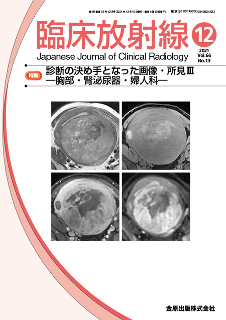 臨床放射線 2021年12月号 66巻13号 特集 診断の決め手となった画像・所見III―胸部・腎泌尿器・婦人科―【電子版】
