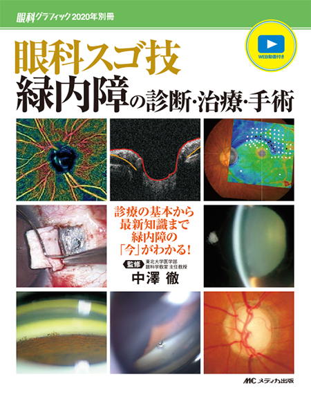 眼科グラフィック2020年別冊 WEB動画付き 眼科スゴ技 緑内障の診断・治療・手術