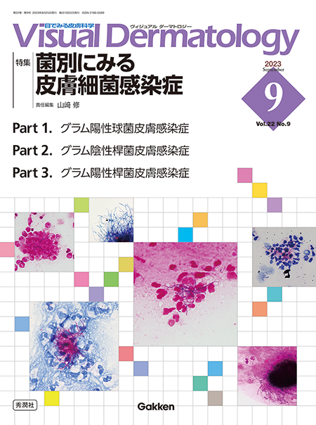 Visual Dermatology Vol.22 No.9（2023年9月号）「菌別にみる皮膚細菌感染症」