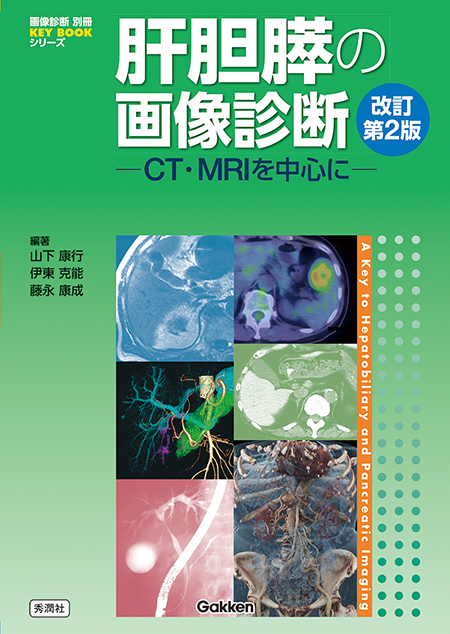 肝胆膵の画像診断 ─CT・MRIを中心に─ 改訂第2版