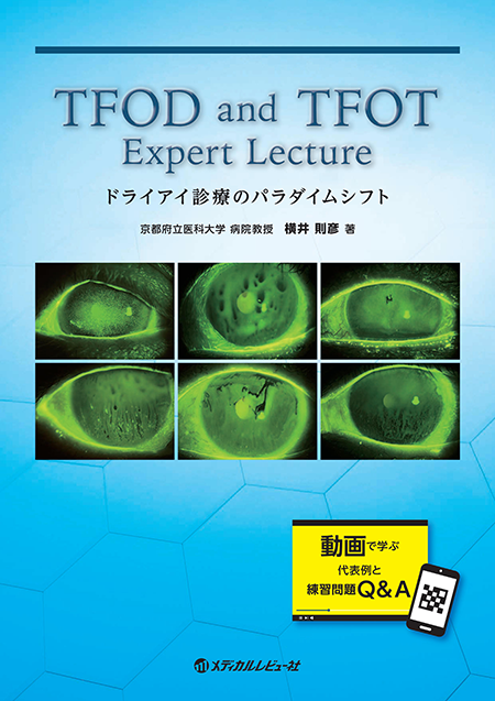 TFOD and TFOT Expert Lecture ドライアイ診療のパラダイムシフト