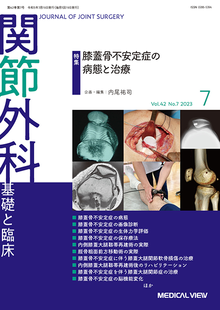 関節外科 2023年7月号 Vol.42 No.7  膝蓋骨不安定症の病態と治療