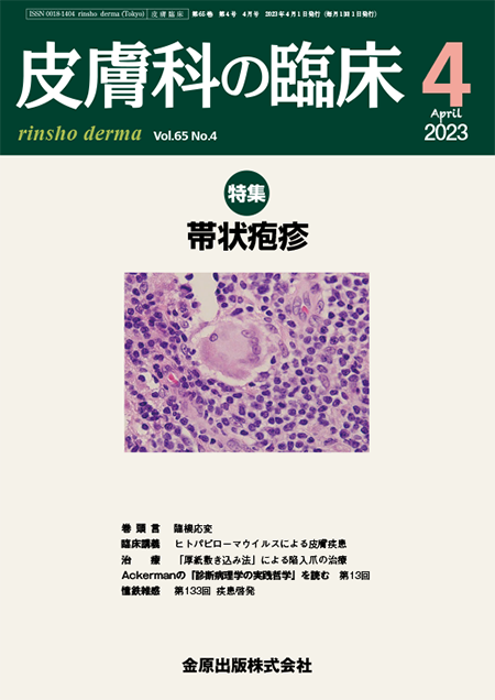 皮膚科の臨床 2023年4月号 65巻4号 特集 帯状疱疹【電子版】