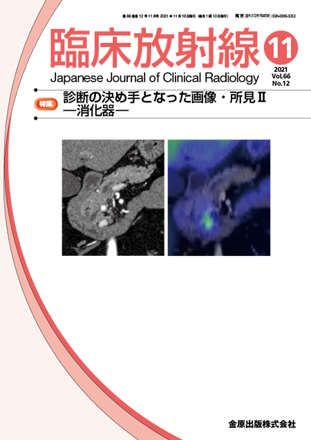 臨床放射線 2021年11月号 66巻12号 特集 診断の決め手となった画像・所見Ⅱ―消化器― 【電子版】
