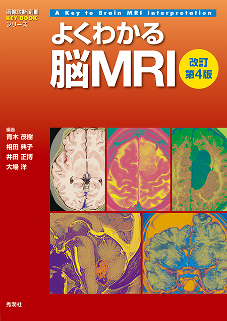 画像診断別冊 KEY BOOKシリーズ よくわかる脳MRI　改訂第4版