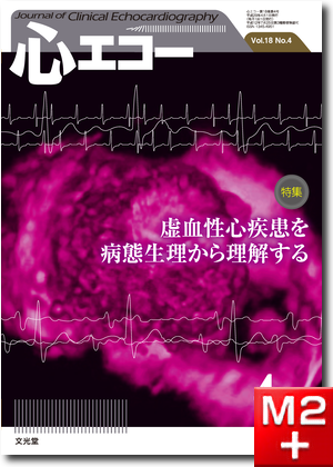 心エコー 2017年4月号（18巻4号）虚血性心疾患を病態生理から理解する